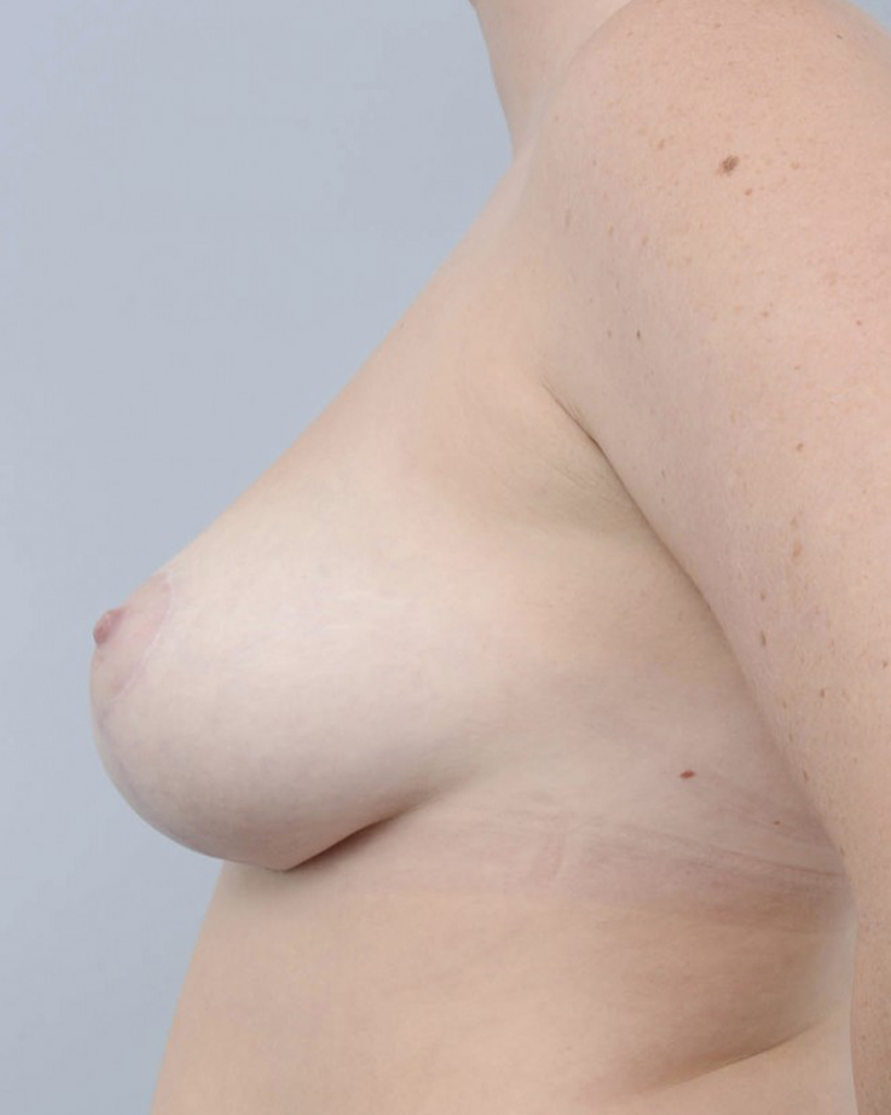 after image