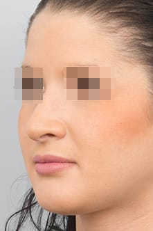 after image