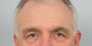 after image